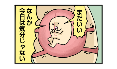 +おまけ_blog